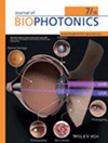 Journal of Biophotonics封面
